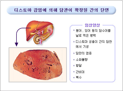 간흡충을 예방합시다